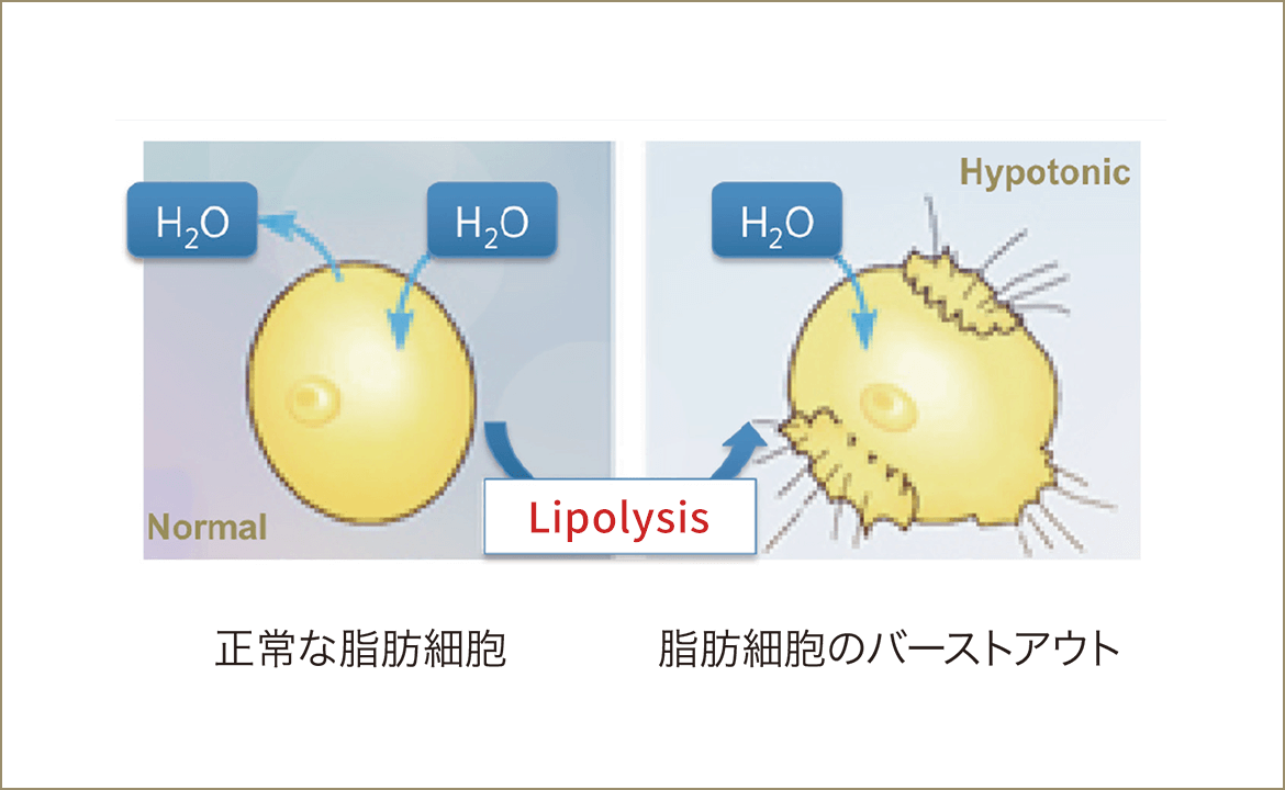 カベリン(カベライン)のオリジナル製法による低張性の脂肪溶解