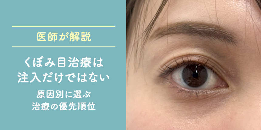 【医師が解説】くぼみ目治療は注入だけではない 原因別に選ぶ治療の優先順位