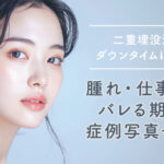 【医師が解説】二重埋没法のダウンタイムは何日？腫れ・仕事復帰・バレる期間を症例写真で解説