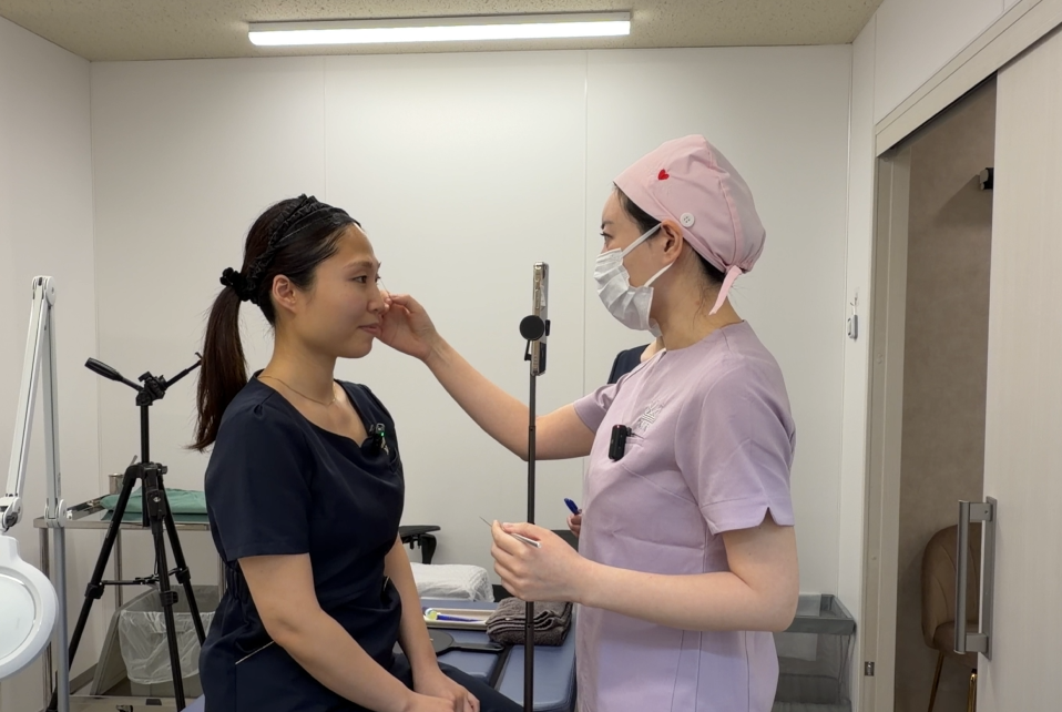 二重埋没法の施術前シミュレーションの様子