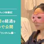 【美容外科スタッフ体験記】二重埋没法ダウンタイム編｜術後1か月の経過を写真付きで公開