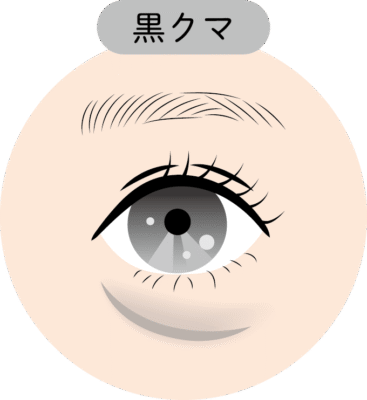 黒クマ