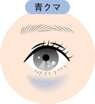 青クマ